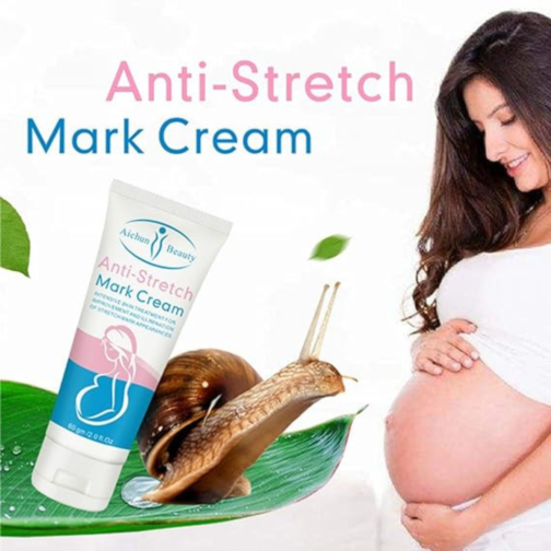 Anti-Stretch Mark Cream- 60g