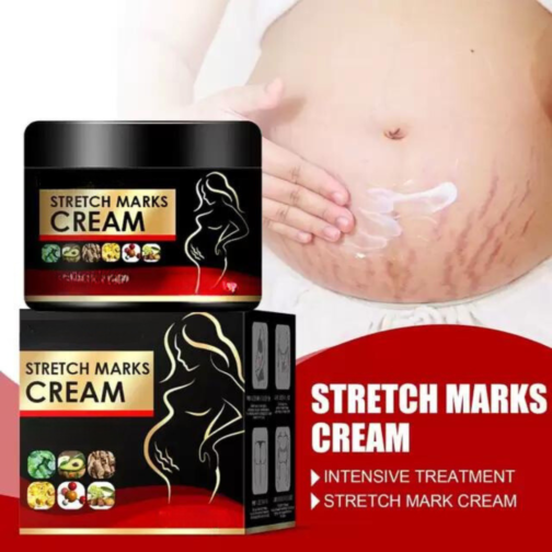 Nice Fresh Stretch Marks Cream - Advanced Formula for Stretch Mark Removal