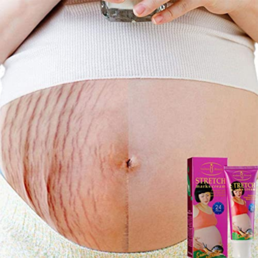 Aichun Beauty Snail Stretch Marks Cream - Image 5